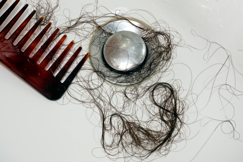 Treating Hair Loss